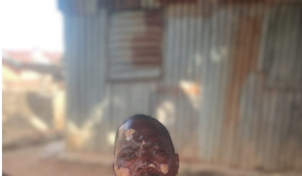 Flammable Refrigerants - Yet Another Fatal Explosion in Nigeria