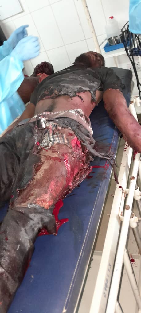 Flammable refrigerants, yet another fatal accident in Zambia